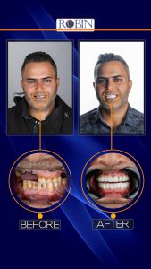 قبل و بعد 2 copy