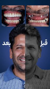 نمونه-قبل-و-بعد (2)