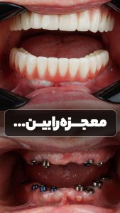 نمونه-کار-1