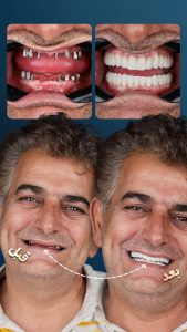 نمونه-کار-استوری-فردا